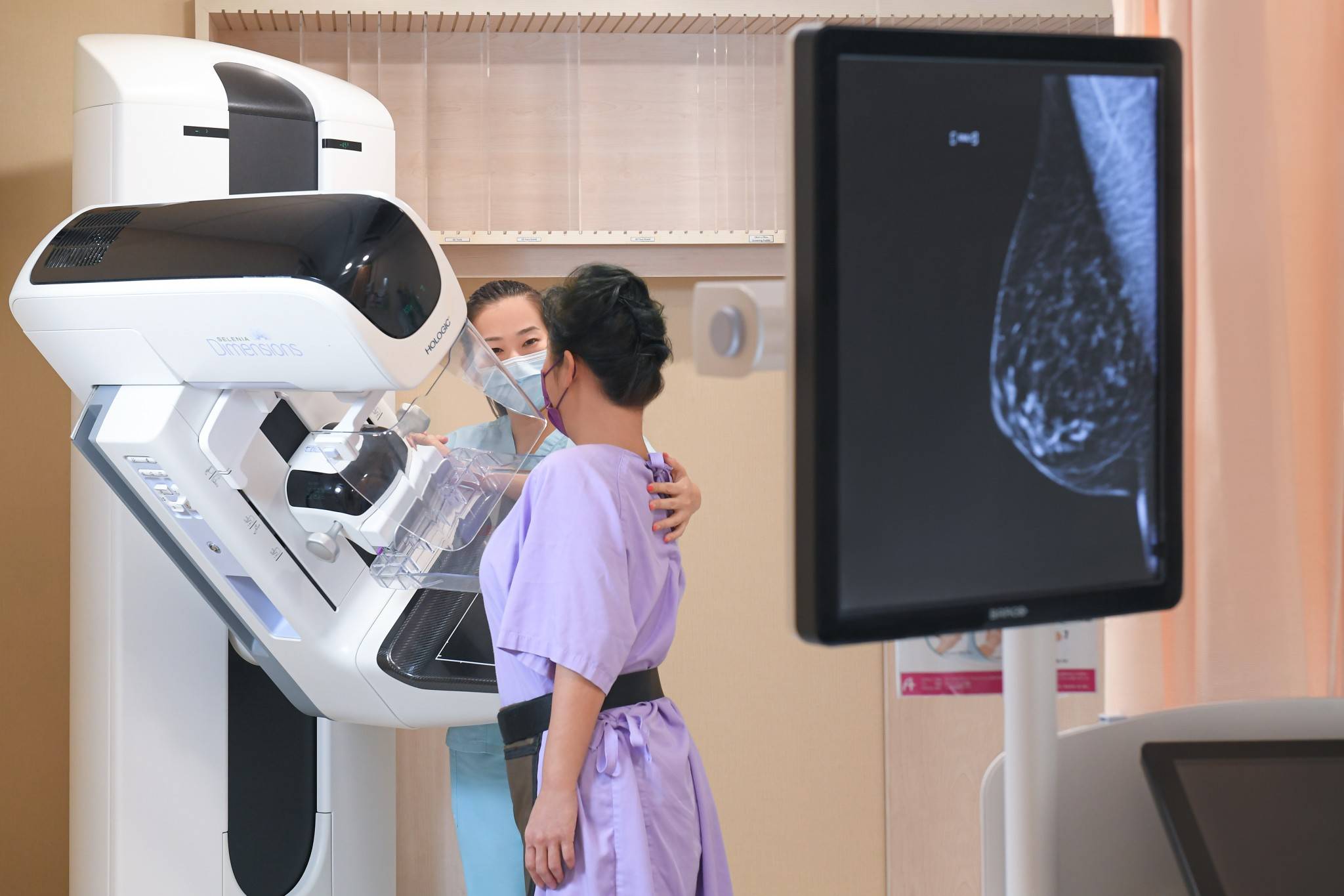 3D Mammogram